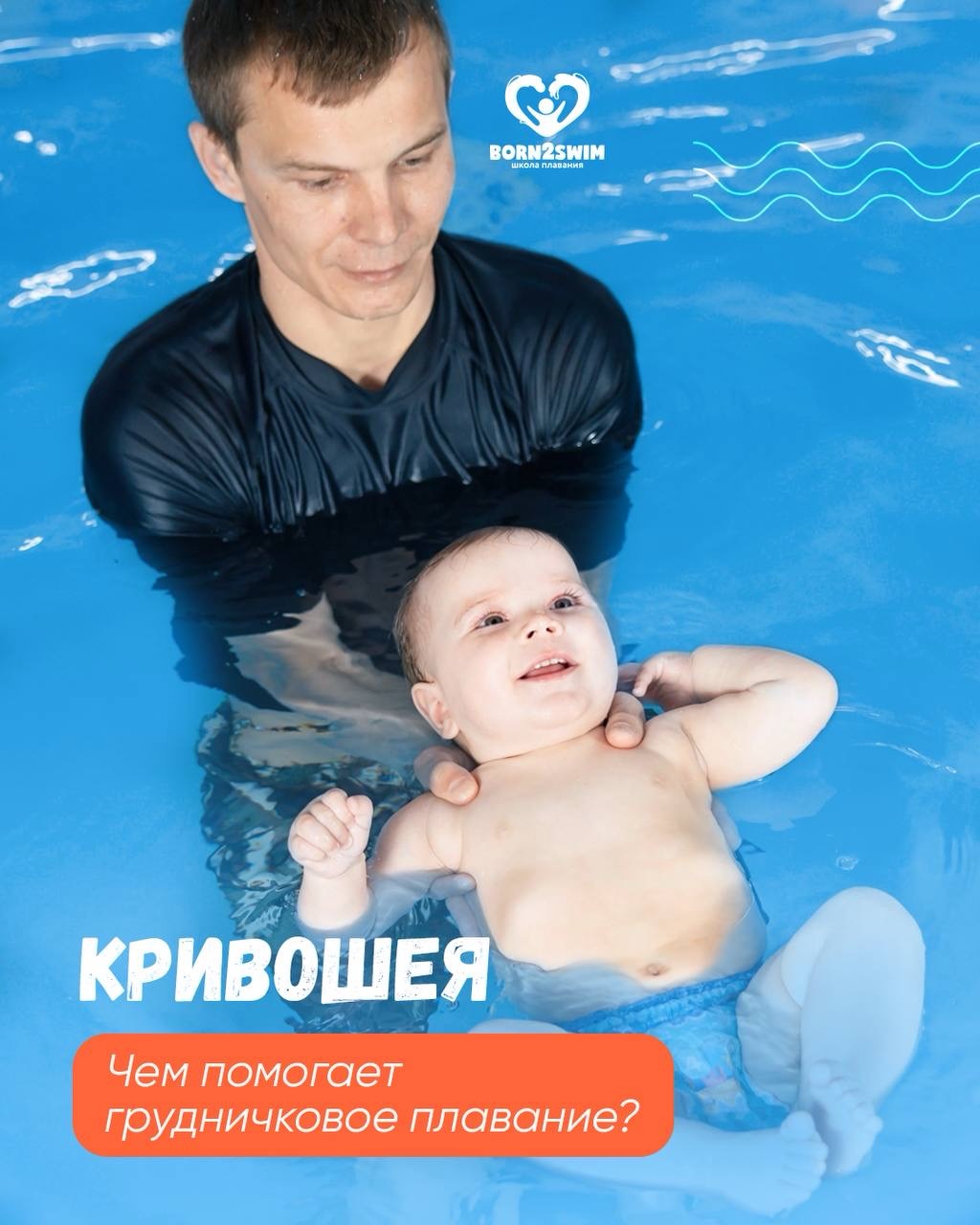 Кривошея часто проявляется уже в первые месяцы жизни, поэтому важно вовремя заметить